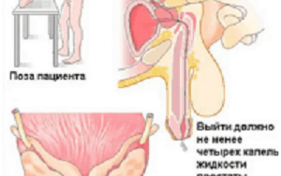 Массаж простаты для повышения потенции