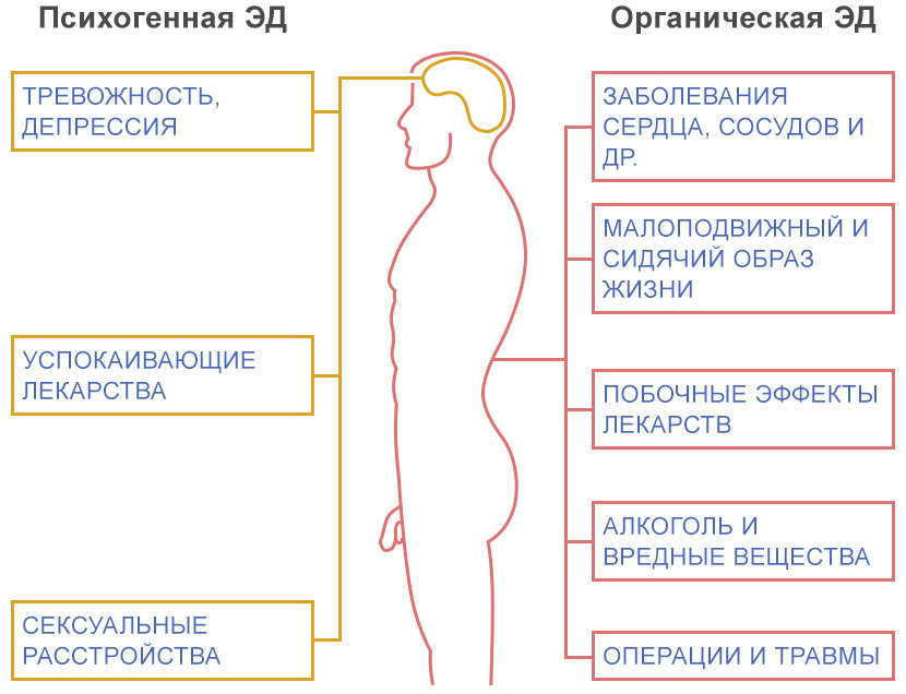 Эректильная дисфункция (импотенция): лечение в Красноярске | Медюнион