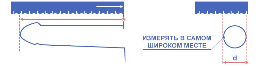 Протезирование полового члена (фаллопротезирование) в Москве: цена операции