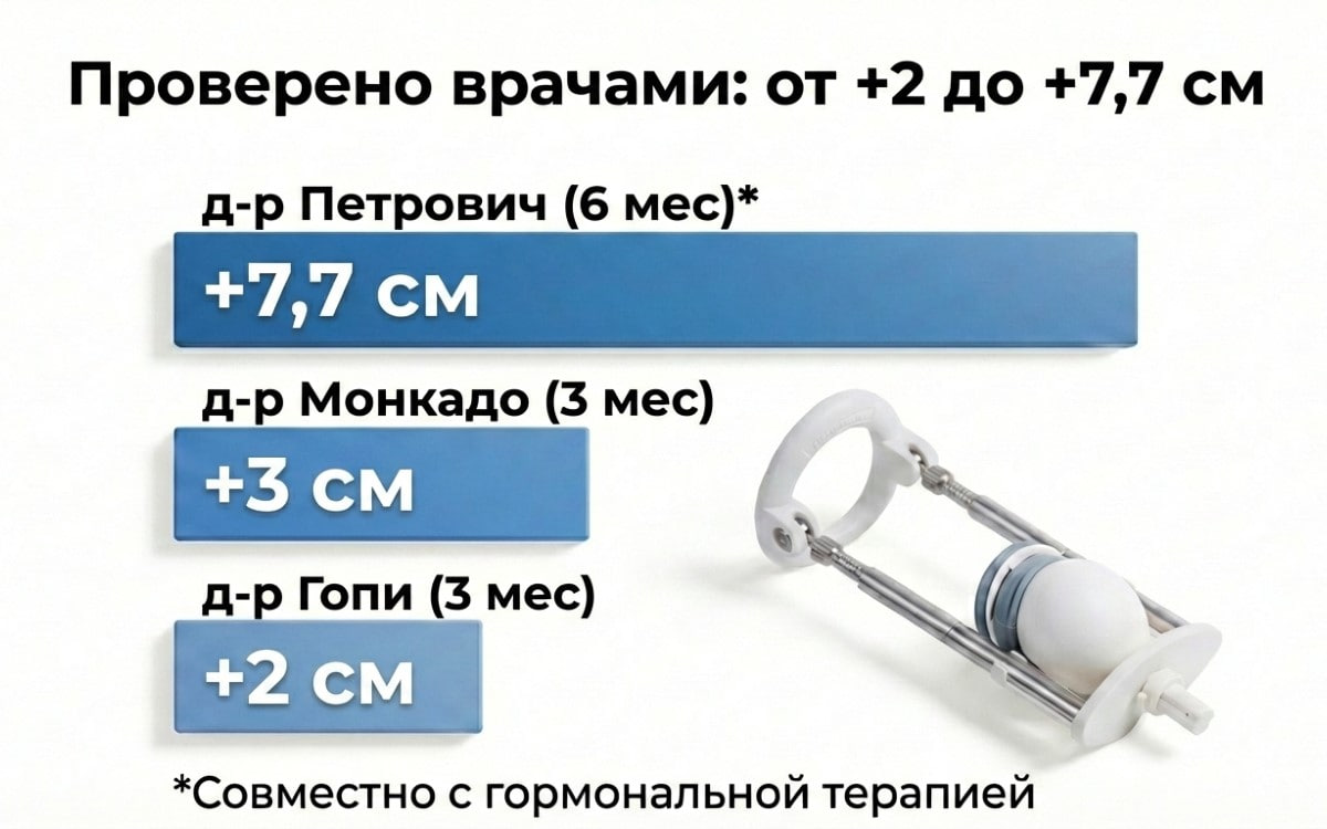 монкада монкада