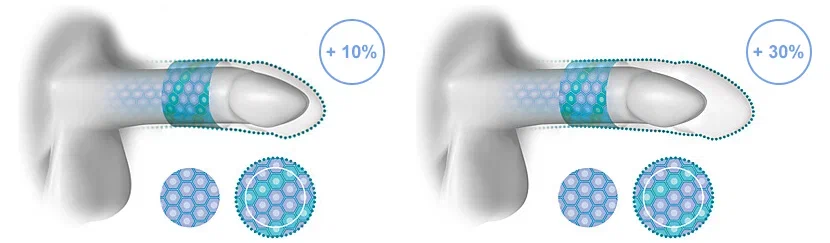 Увеличение размера полового члена в длину