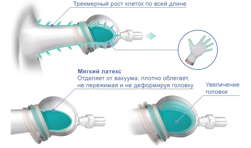 Как работает PeniMaster Pro?