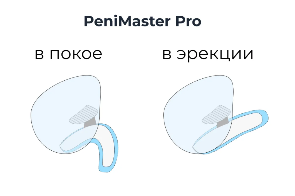 penimaster pro rezultat 